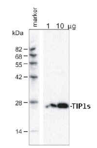 TIP1;1,TIP1;2 | tonoplast intrinistic protein1-1, 1-2 (gamma) in the group Antibodies for Plant/Algal / Membrane Transport System / Vacuolar membrane at Agrisera AB (Antibodies for research) (AS09 492)